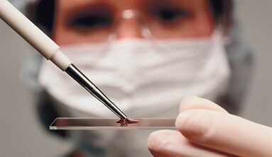 Bambancin ganewar asali na sifa da kuma arthrosis