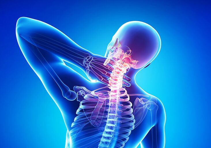 Spinal osteochondrosis cuta ce da ke shafar guringuntsi da kashin baya.